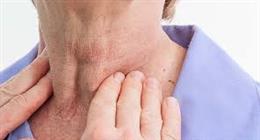 علامات تكشف الإصابة بسرطان الغدة الدرقية.. اذهب للطبيب فورا 